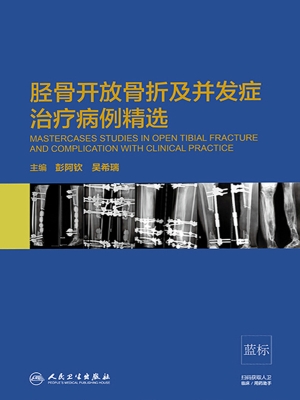 胫骨开放骨折及并发症