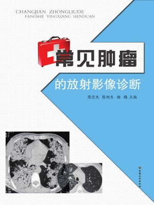 常见肿瘤的放射影像诊