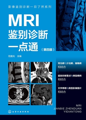 MRI鉴别诊断一点通