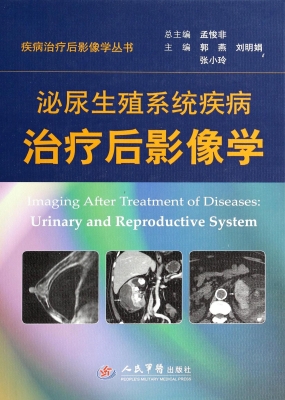 泌尿生殖系统疾病治疗
