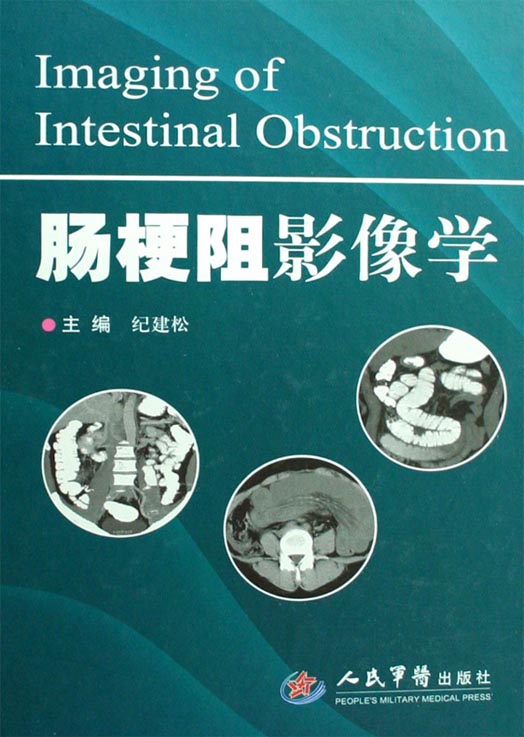肠梗阻影像学