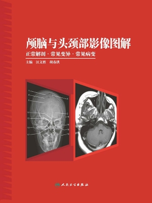 颅脑与头颈部影像图解
