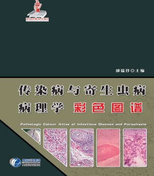 传染病与寄生虫病病理