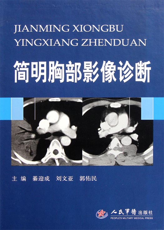 简明胸部影像诊断