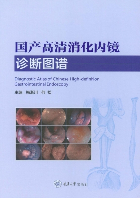 国产高清消化内镜诊断