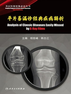 平片易漏诊经典疾病解