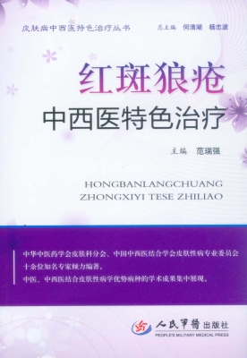 红斑狼疮中西医特色治