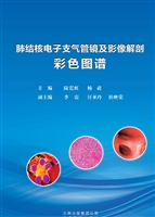 肺结核电子支气管镜及