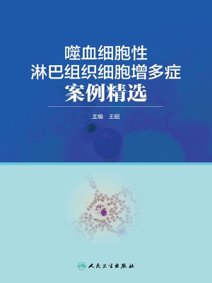 噬血细胞性淋巴组织细