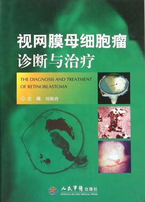 视网膜母细胞瘤诊断与