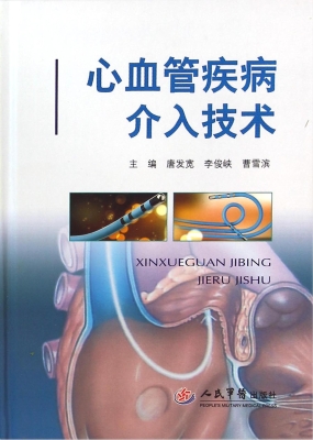 心血管疾病介入技术