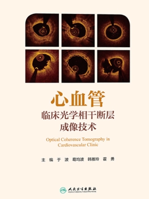 心血管临床光学相干断
