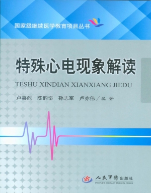 特殊心电现象解读