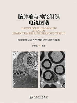 脑肿瘤与神经组织电镜