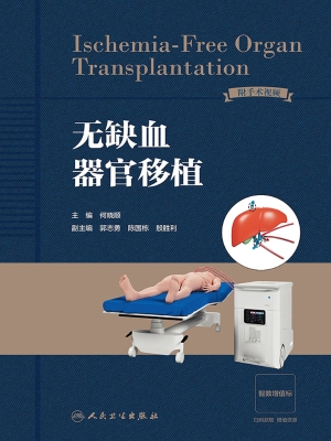 无缺血器官移植