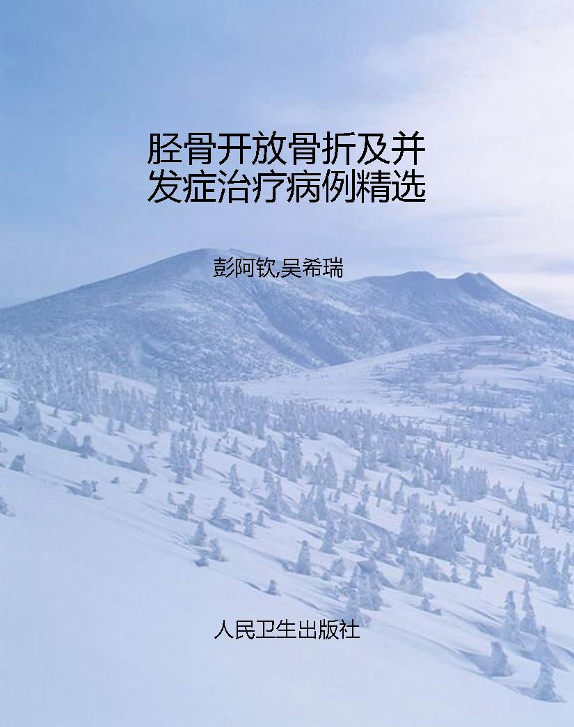 胫骨开放骨折及并发症