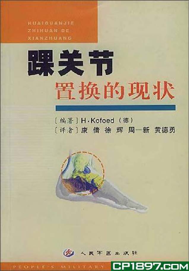 踝关节置换的现状