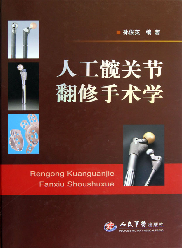 人工髋关节翻修手术学