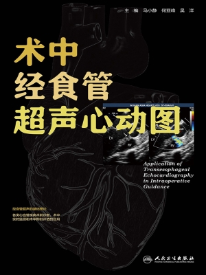 术中经食管超声心动图