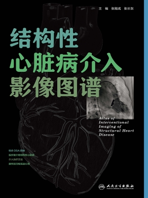 结构性心脏病介入影像