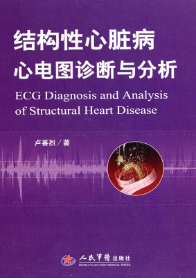 结构性心脏病心电图诊