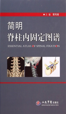 简明脊柱内固定图谱