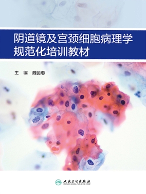 阴道镜及宫颈细胞病理