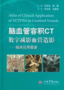脑血管容积CT数字减影