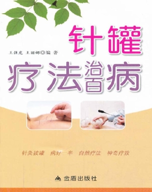 针罐疗法治百病