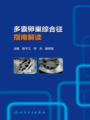 多囊卵巢综合征指南解