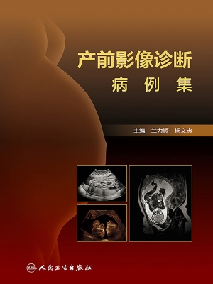 产前影像诊断病例集