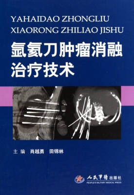 氩氦刀肿瘤消融治疗技