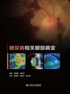 糖尿病相关眼部病变