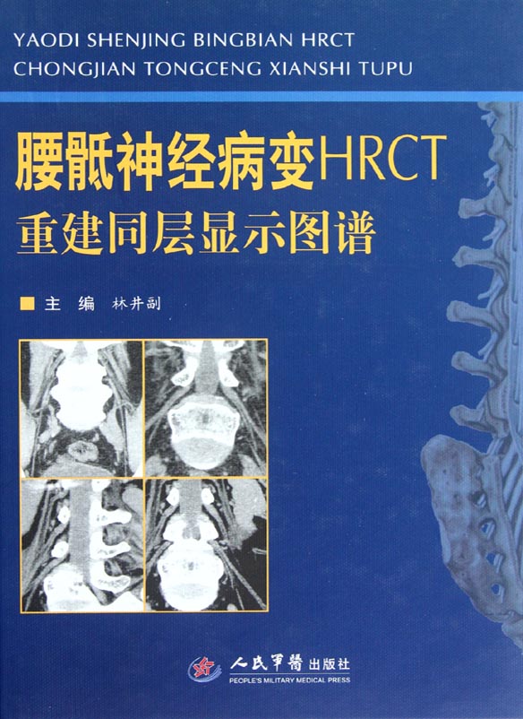 腰骶神经病变HRCT——