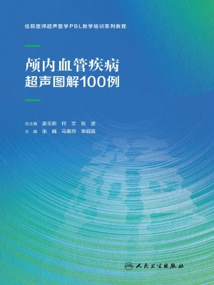 颅内血管疾病超声图解