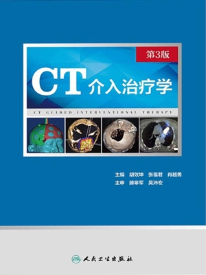 CT介入治疗学