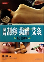 图解刮痧 拔罐 艾灸祛