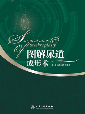 图解尿道成形术