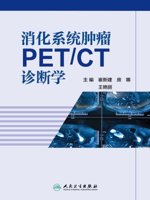 消化系统肿瘤PET/CT诊