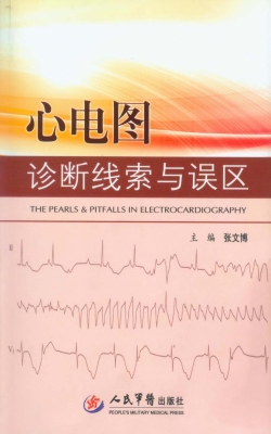 心电图诊断线索与误区