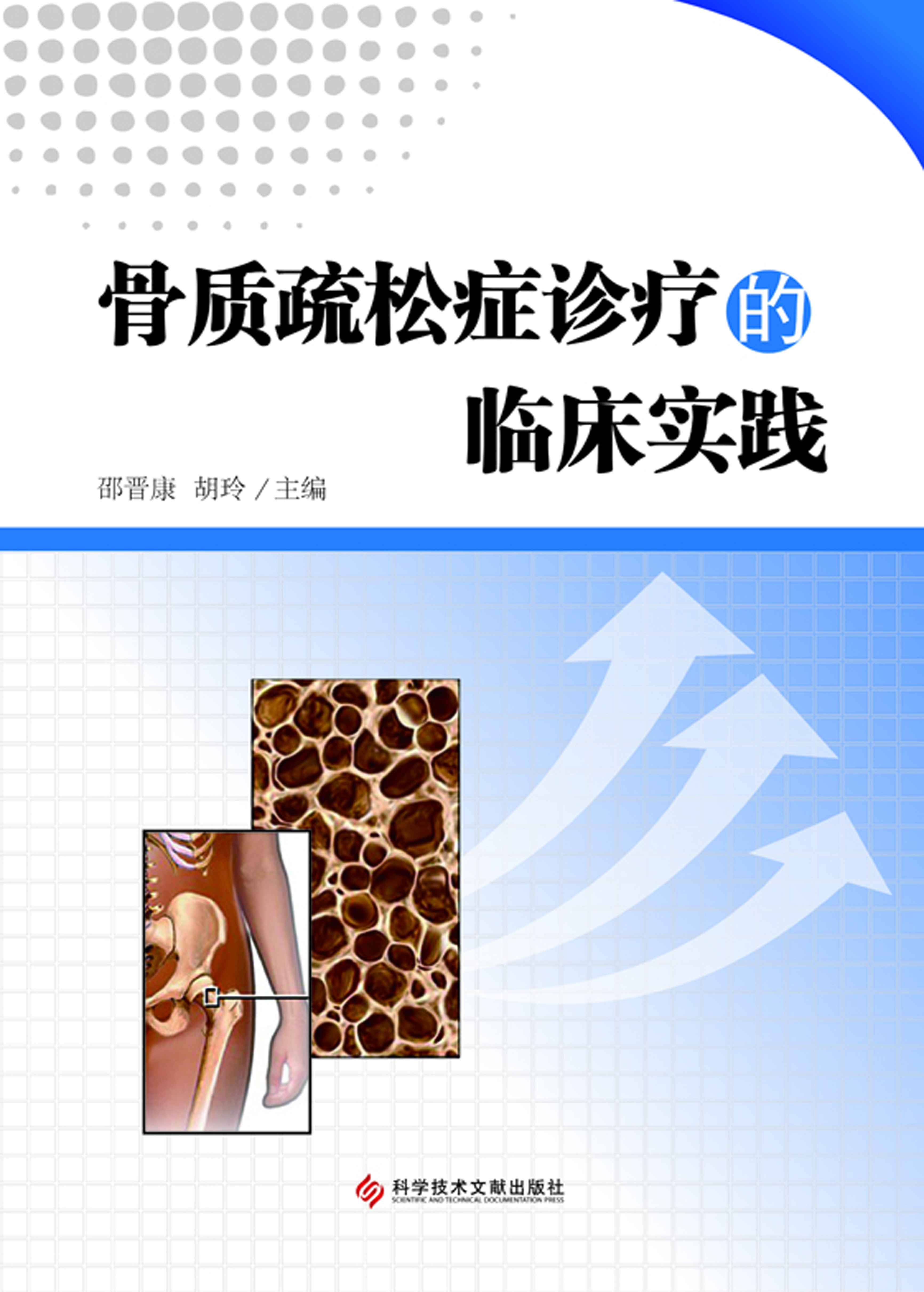 骨质疏松症诊疗的临床