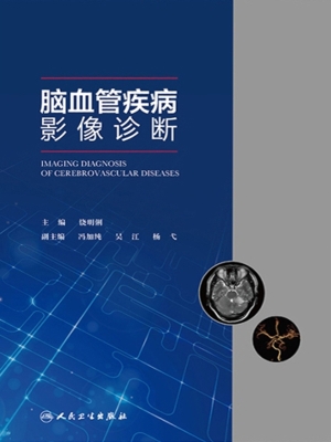 脑血管疾病影像诊断