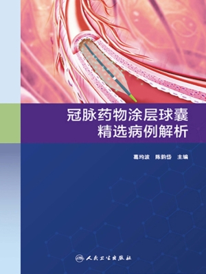 冠脉药物涂层球囊精选