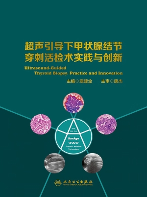超声引导下甲状腺结节