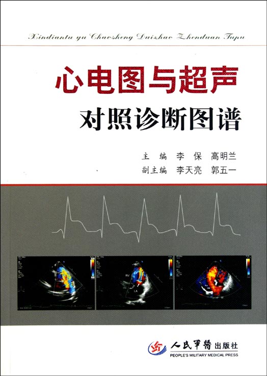 心电图与超声对照诊断