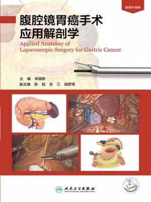 腹腔镜胃癌手术应用解
