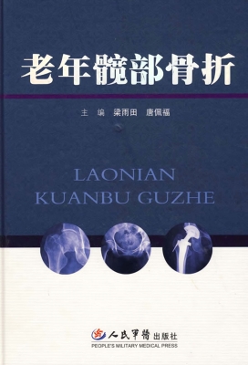 老年髋部骨折