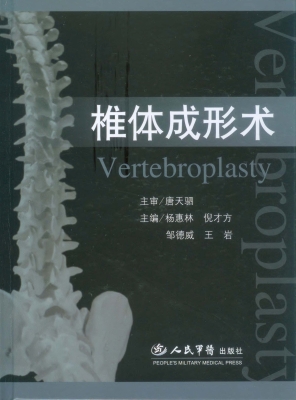 椎体成形术