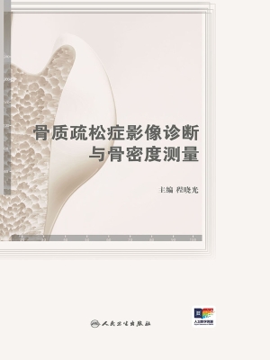 骨质疏松症影像诊断与