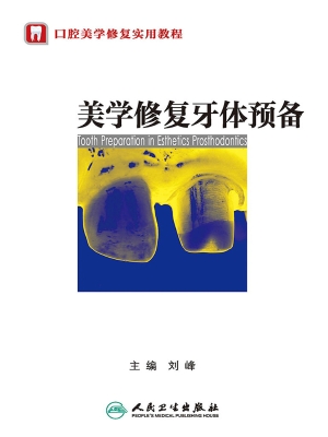 美学修复牙体预备
